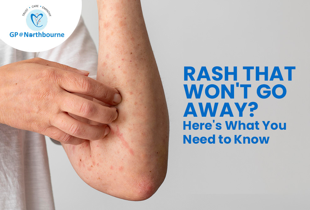 Rash That Wont Go Away Here’s What You Need to Know