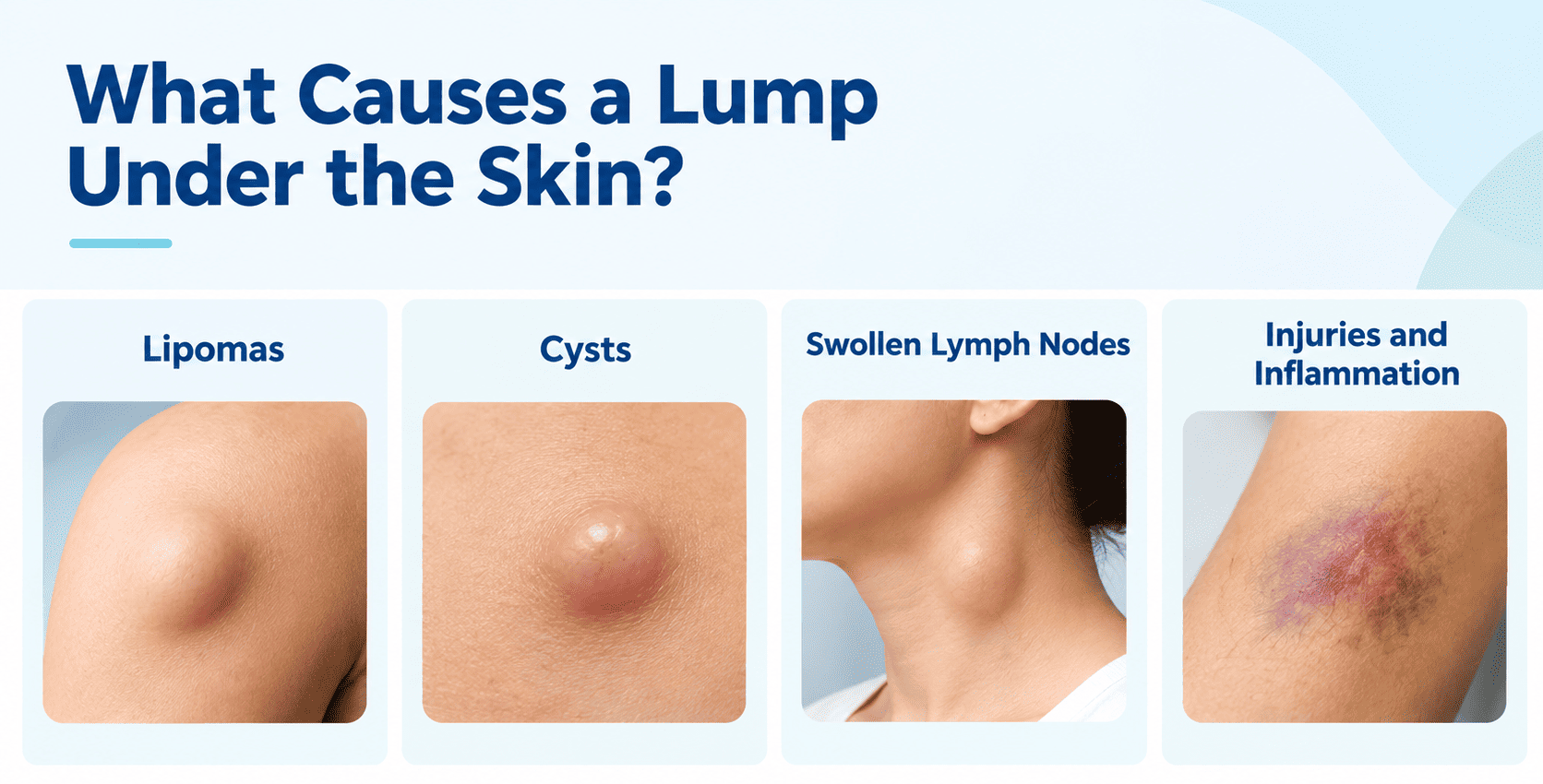 What Causes a Lump Under the Skin (1)