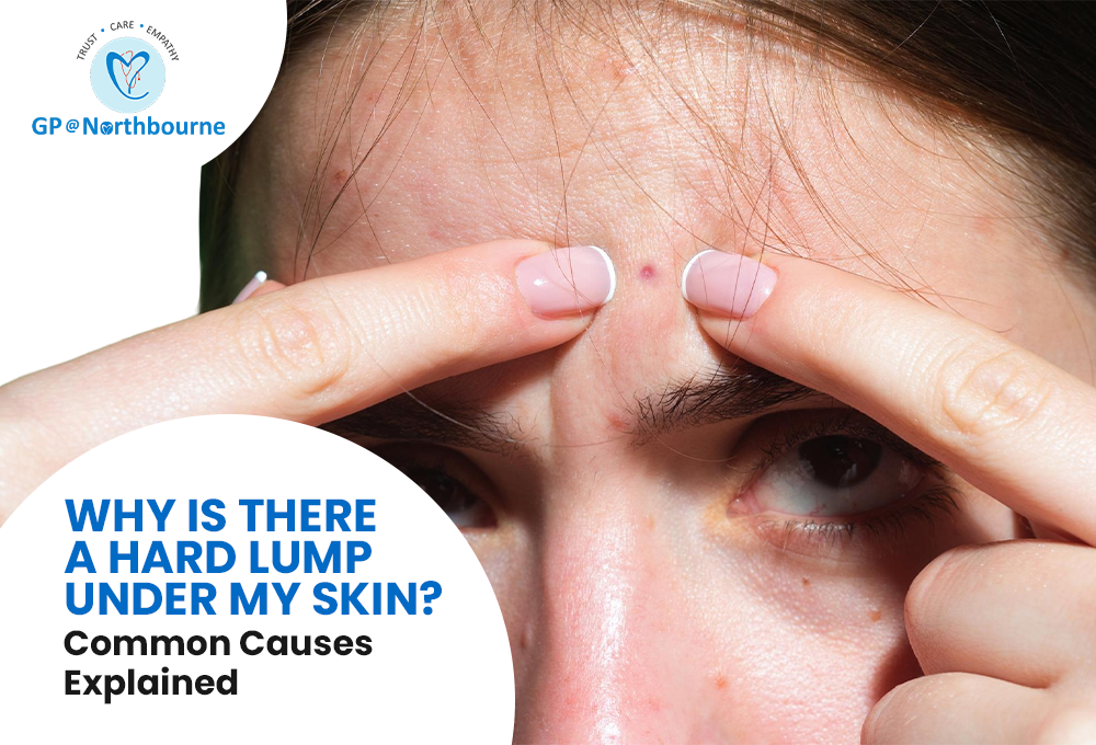 Why Is There a Hard Lump Under My Skin Common Causes Explained